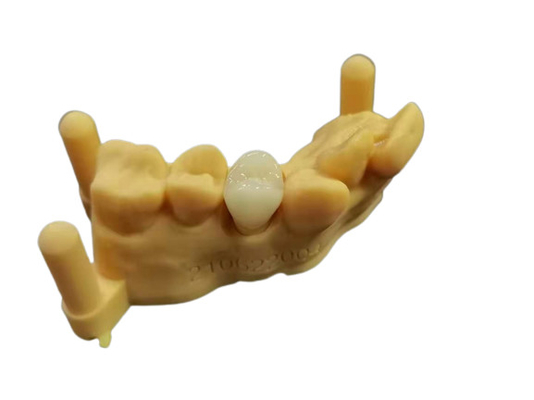適用範囲が広いアクリルの総義歯の歯科実験室のデジタル設計を印刷しているOEM 3D