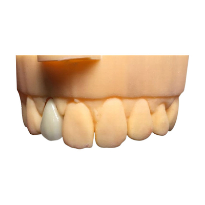 Chromecastの安全PFM歯科王冠橋よいBiocompatibility