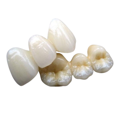 PFM CoのCr 3014652903の陶磁器の歯科橋注文色安定性