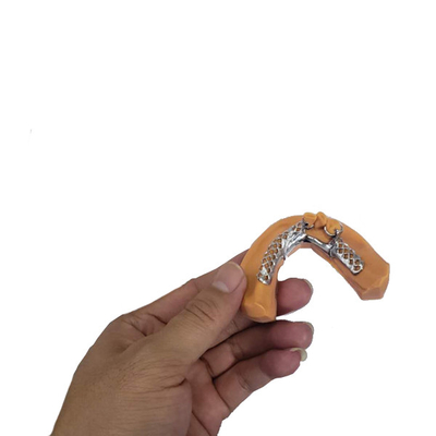 歯科医療のための取り外し可能な歯科王冠フレームワーク モデルを印刷する3D
