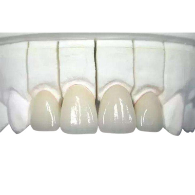 3Dはジルコニアの歯科王冠の耐久力のある非常にBiocompatible印刷した