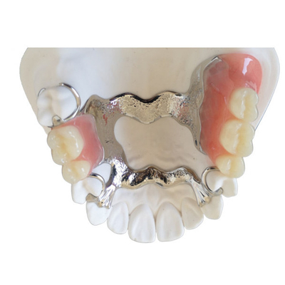 OEM 3DプリンターPFM歯科王冠橋高い生物的Intermiscibility