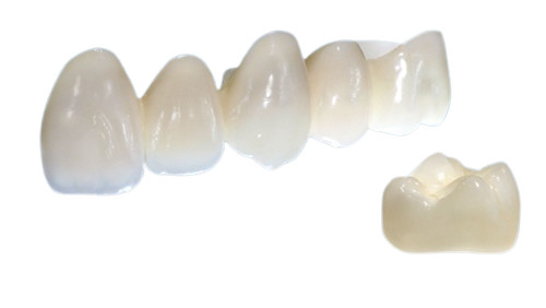磁器の王冠は色でリアルで、安定性で強い形で美しい