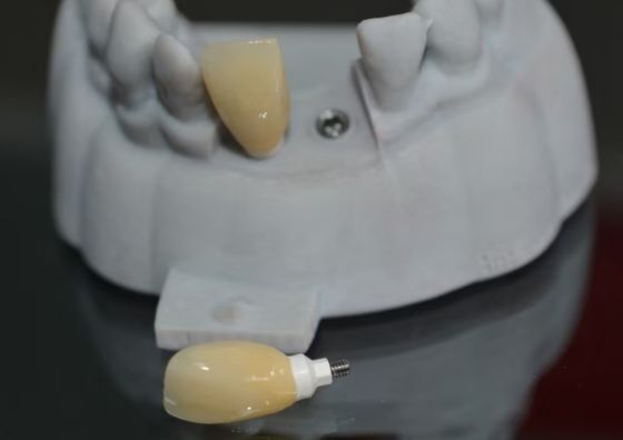 CAD PEEK カスタムアバットメント