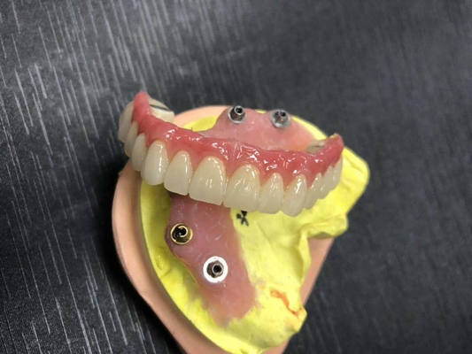 FDA 3014652903番のPFM橋歯科非常に審美的な非常に強い