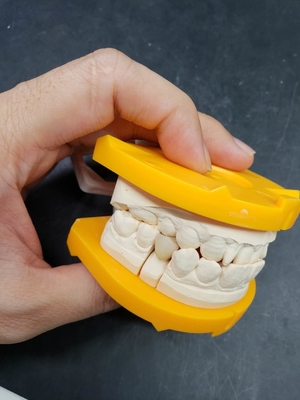 私達の陶磁器の歯科王冠の中心の革新