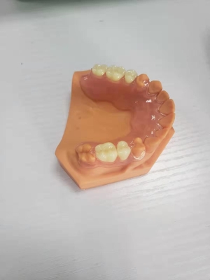 3Dはデジタル データに基づいて歯科実験室のための総義歯を印刷した