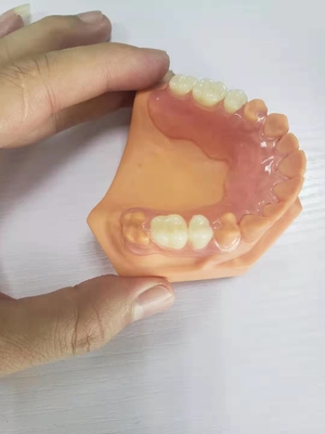 3Dはデジタル データに基づいて歯科実験室のための総義歯を印刷した