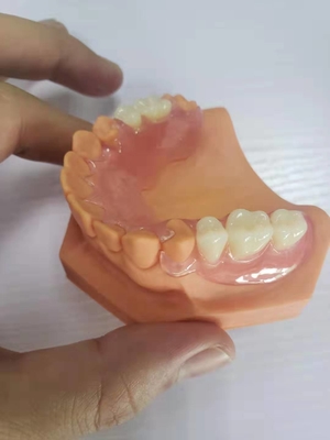 3Dはデジタル データに基づいて歯科実験室のための総義歯を印刷した