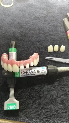 Resin-Based CAD-CAMは取り外し可能な橋美学の復帰を固定した
