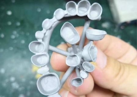 カスタマイズされたPFMの磁器の歯科王冠の完全な金属の耐食性