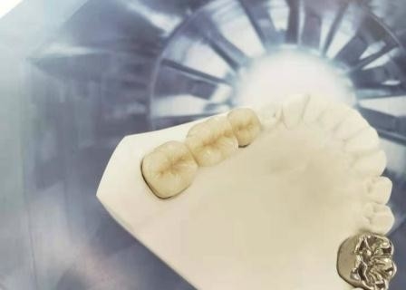 OEMの磨く磁器の歯科王冠高い生物的Intermiscibility