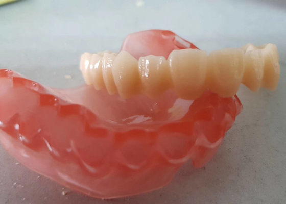 現実的なデジタル データOEM 3Dは歯科医の調査のための歯科モデルを印刷した