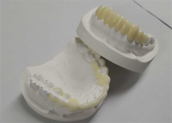 高耐久性CADCAM3D印刷テンポラリークラウン耐久性レジン