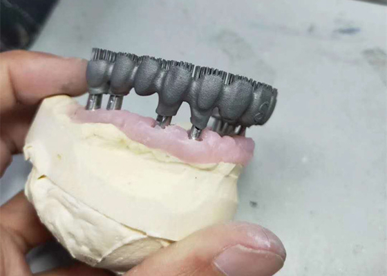 耐久CAD CAM PFM 3Dプリンター歯科実験室は研究のために印刷する