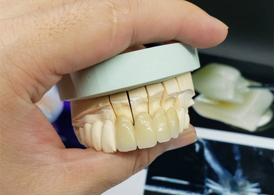 安全防蝕OEMの磁器の王冠すべての陶磁器の自然な一見