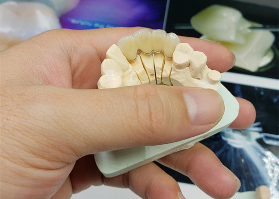 安全防蝕OEMの磁器の王冠すべての陶磁器の自然な一見
