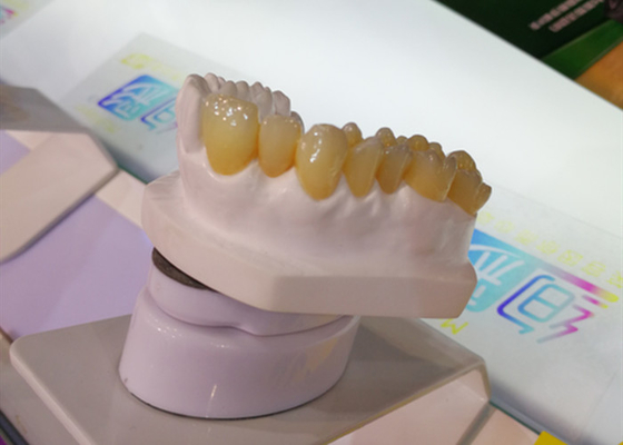 CAD CAMの設計PFM歯科王冠の実験室3Dプリンター歯科王冠