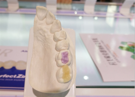 注文の高密度注文の歯科製陶術のFDAの全陶磁器の王冠