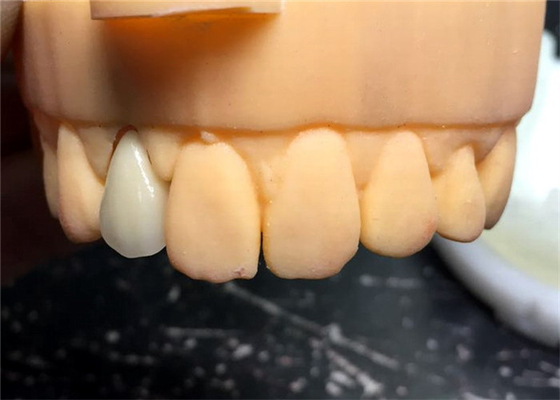 Chromecastの安全PFM歯科王冠橋よいBiocompatibility