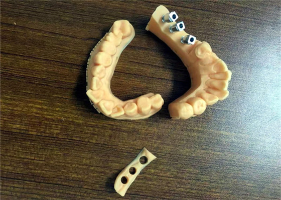 FDA 3Dは歯科モデル金属をかぶせるために溶けた歯科王冠の磁器を印刷した