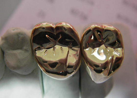 高力FMCの金属の王冠の歯の半貴金属の王冠