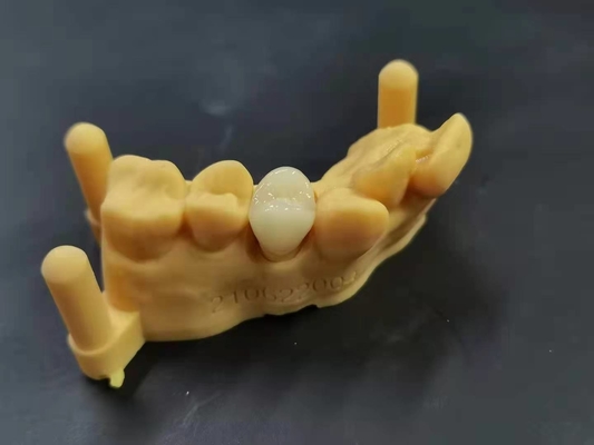 適用範囲が広いアクリルの総義歯の歯科実験室のデジタル設計を印刷しているOEM 3D