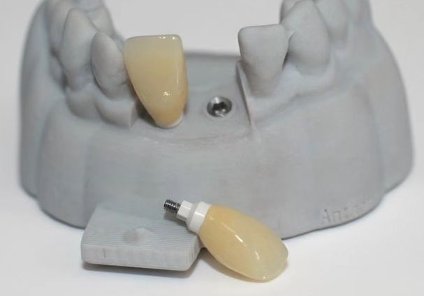 CAD PEEK カスタムアバットメント